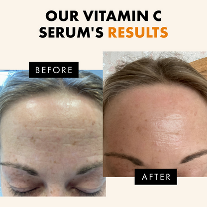 Brightening Vitamin C Serum - Eclat