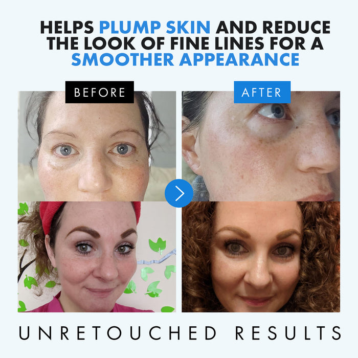 Hyaluronic Acid Serum for Face - Eclat